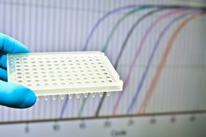 写真：定量的PCR