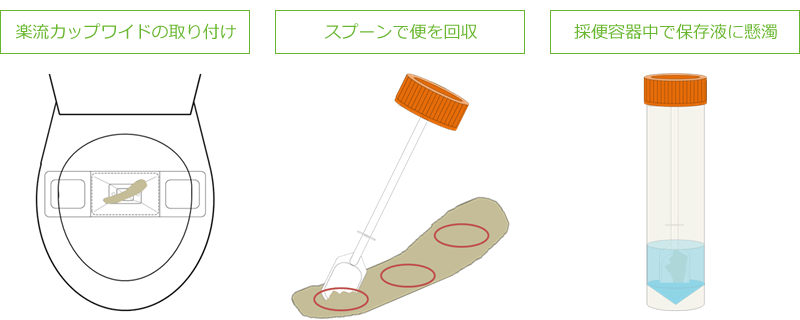 イラスト：糞便の採取方法　採便シートの取り付け、スプーンあるいはブラシで便を回収、採便容器中で保存液に懸濁